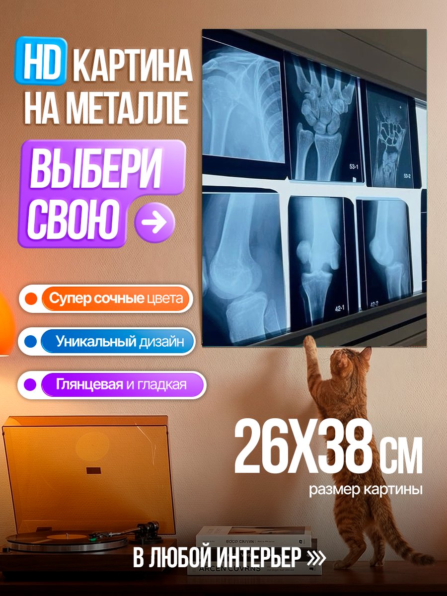 Картина на металле Рентгеновские снимки костей