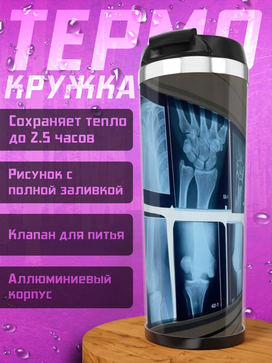 Термокружка Рентгеновские снимки костей